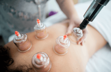Image for CBD Massage with Cupping